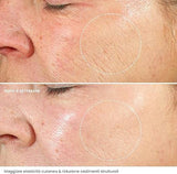 crema-viso-antirughe-acido-ialuronico-con-retinolo-e-collagene