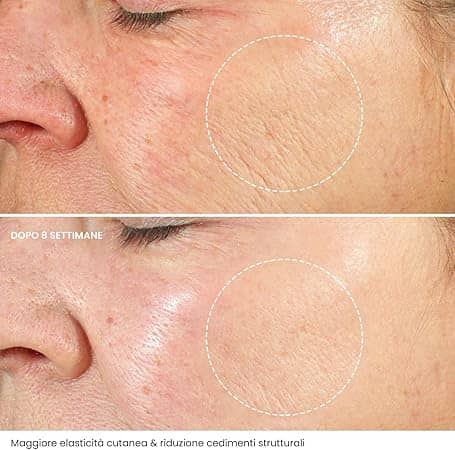 crema-viso-antirughe-acido-ialuronico-con-retinolo-e-collagene